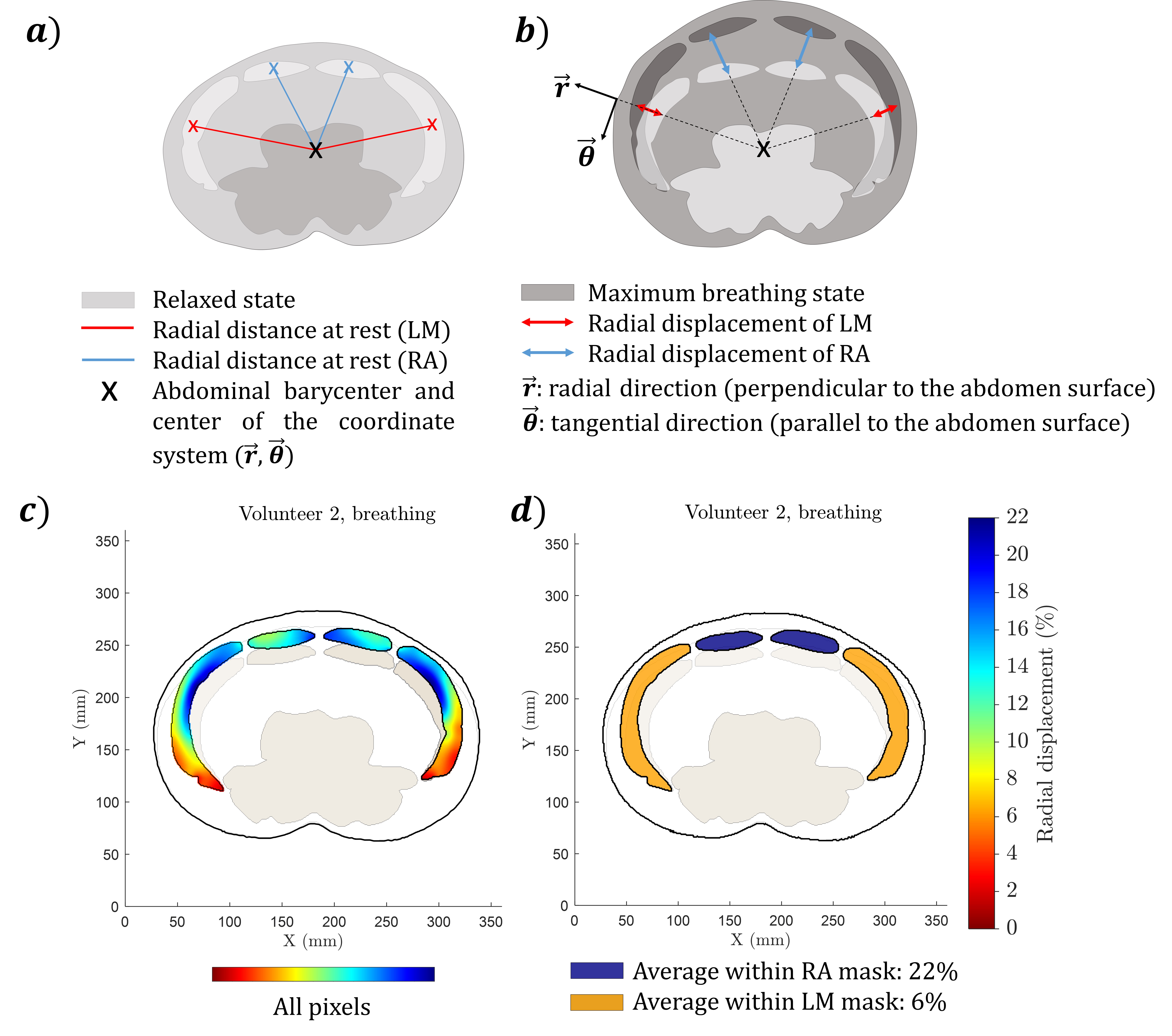 intra-abdominal-pressure Diagram
