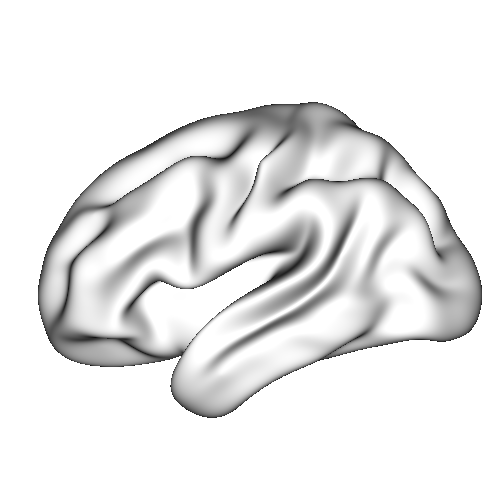 intracranial-pressure-monitor Diagram