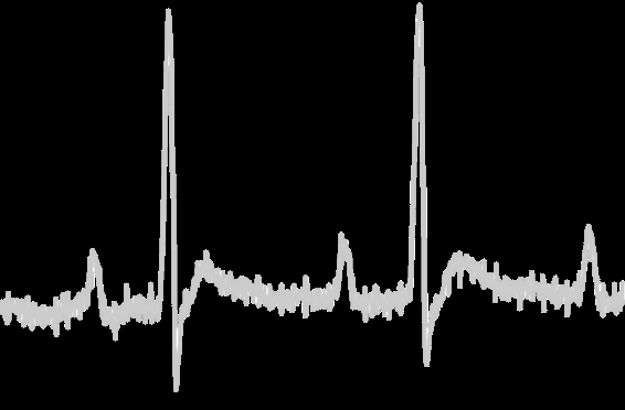 max30003-biopotential-afe Diagram