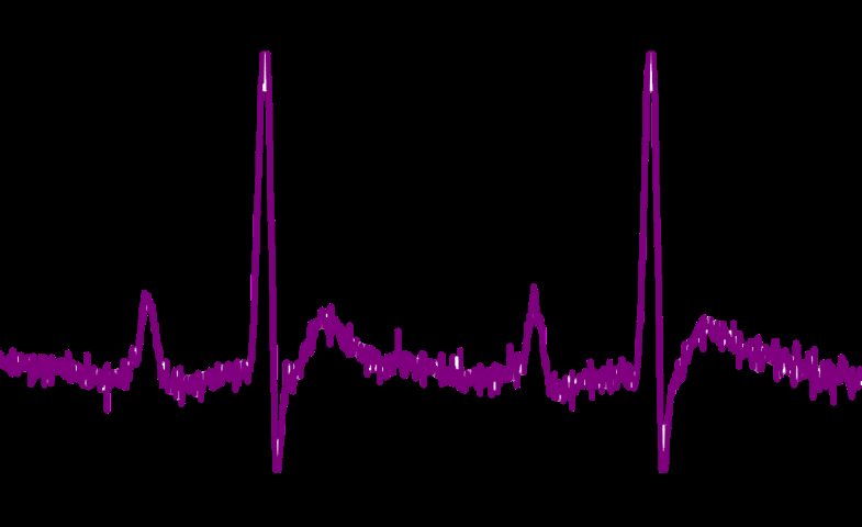 max30003-biopotential-afe Diagram