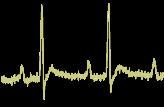 max30003-biopotential-afe Diagram