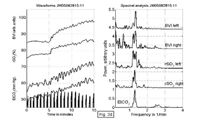 near-infrared-spectroscopy-brain Diagram