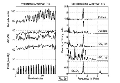 near-infrared-spectroscopy-brain Diagram