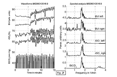 near-infrared-spectroscopy-brain Diagram