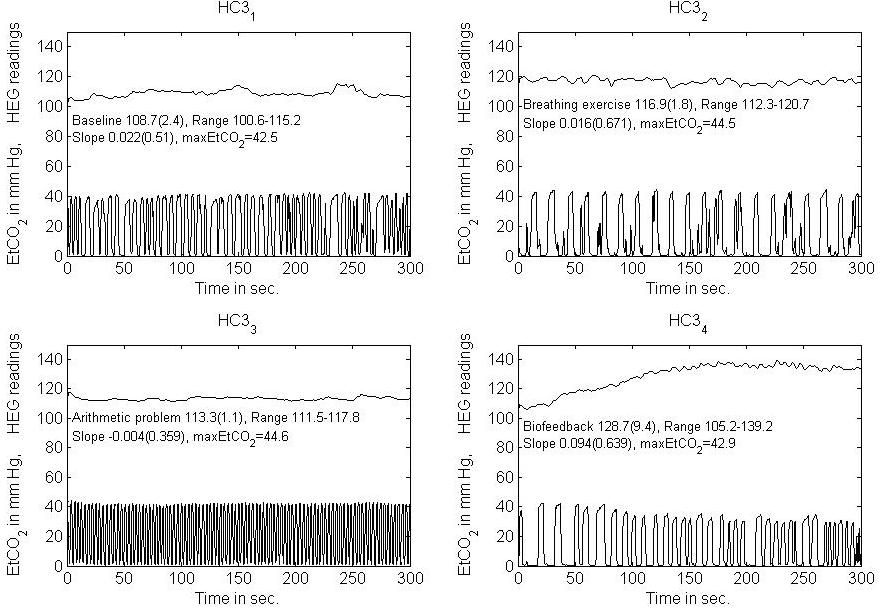 near-infrared-spectroscopy-brain Diagram