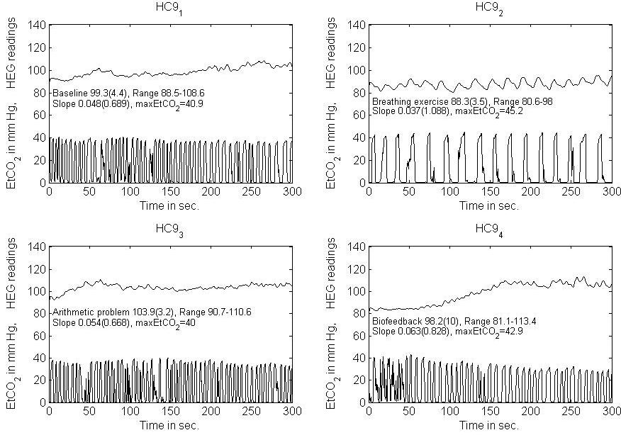 near-infrared-spectroscopy-brain Diagram