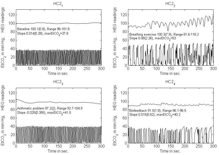 near-infrared-spectroscopy-brain Diagram