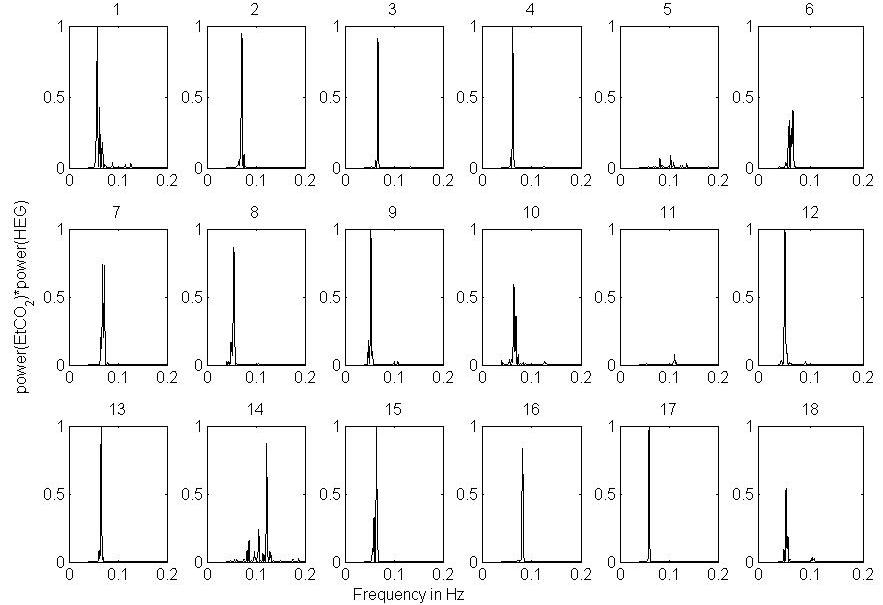 near-infrared-spectroscopy-brain Diagram