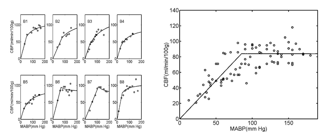 near-infrared-spectroscopy-brain Diagram