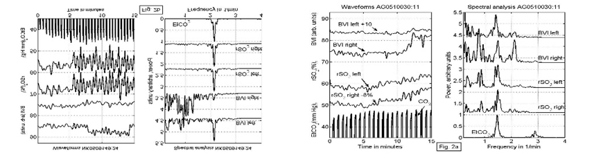 near-infrared-spectroscopy-brain Diagram