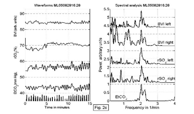 near-infrared-spectroscopy-brain Diagram
