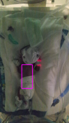 neonatal-vital-signs-monitor Diagram