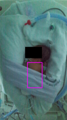 neonatal-vital-signs-monitor Diagram