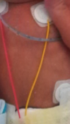 neonatal-vital-signs-monitor Diagram