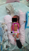 neonatal-vital-signs-monitor Diagram
