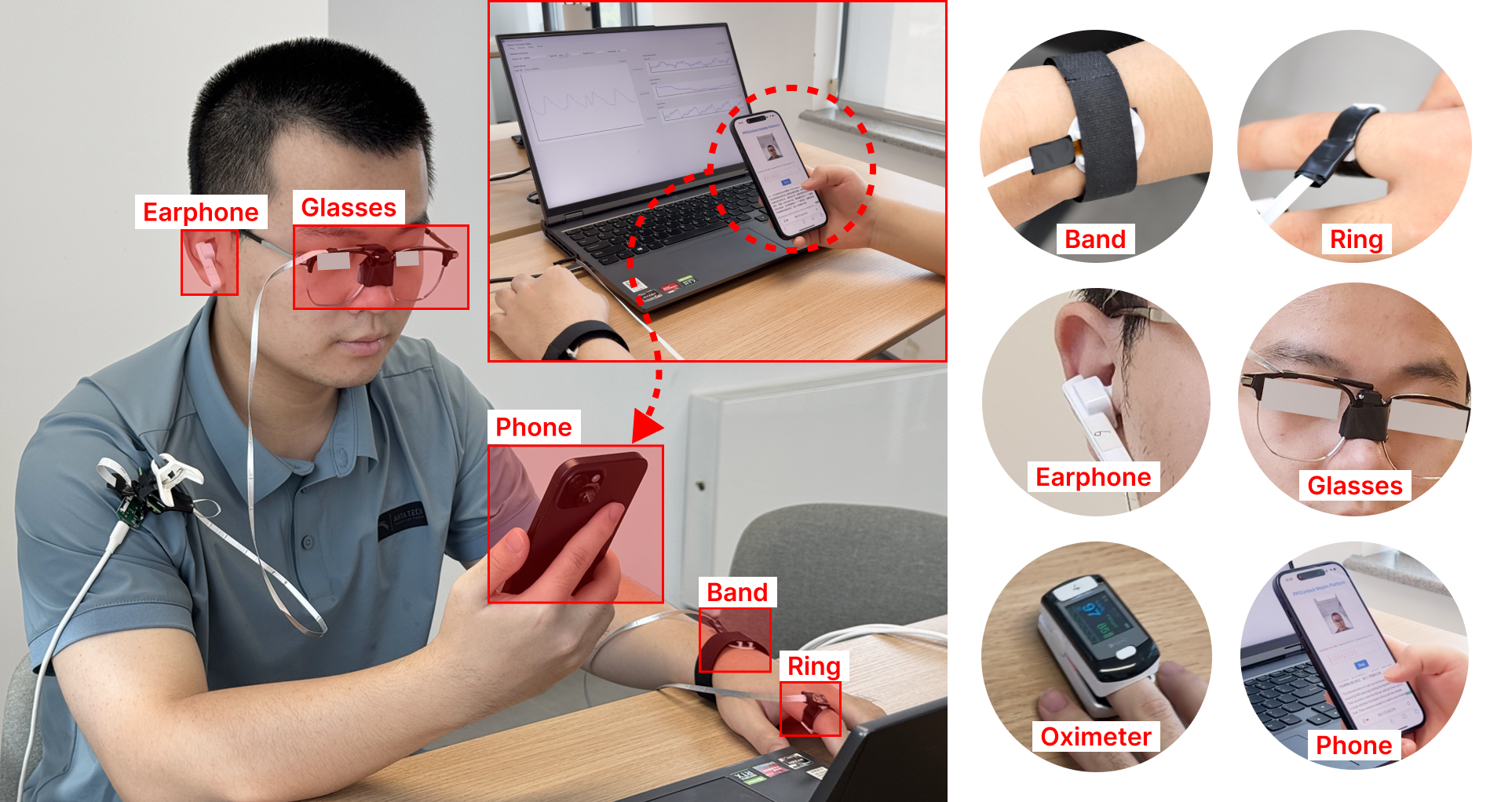 photoplethysmography-wearable Diagram