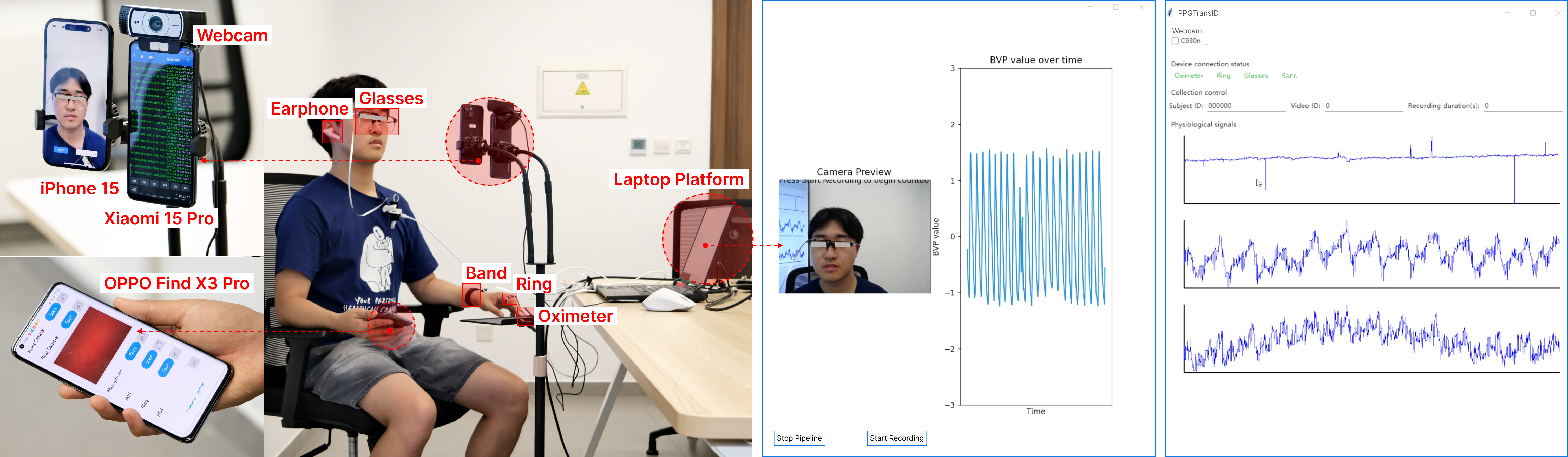 photoplethysmography-wearable Diagram