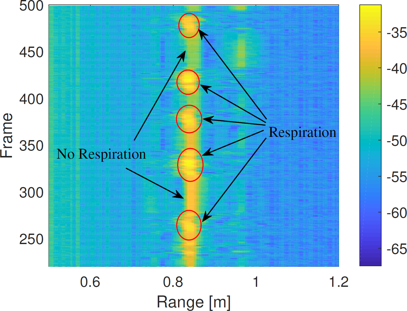 radar-based-breathing-monitor Diagram