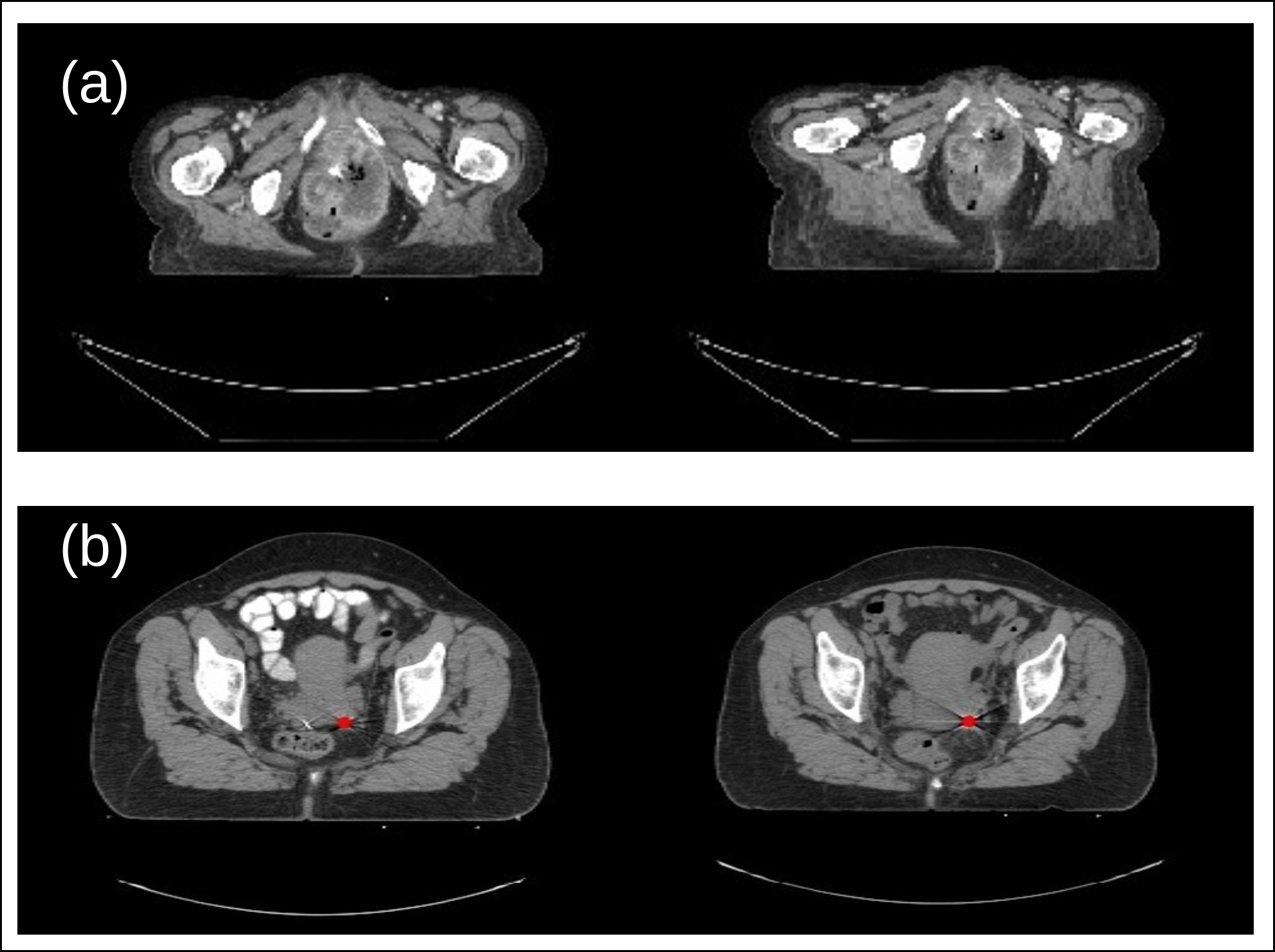 raspberry-pi-medical-imaging Diagram