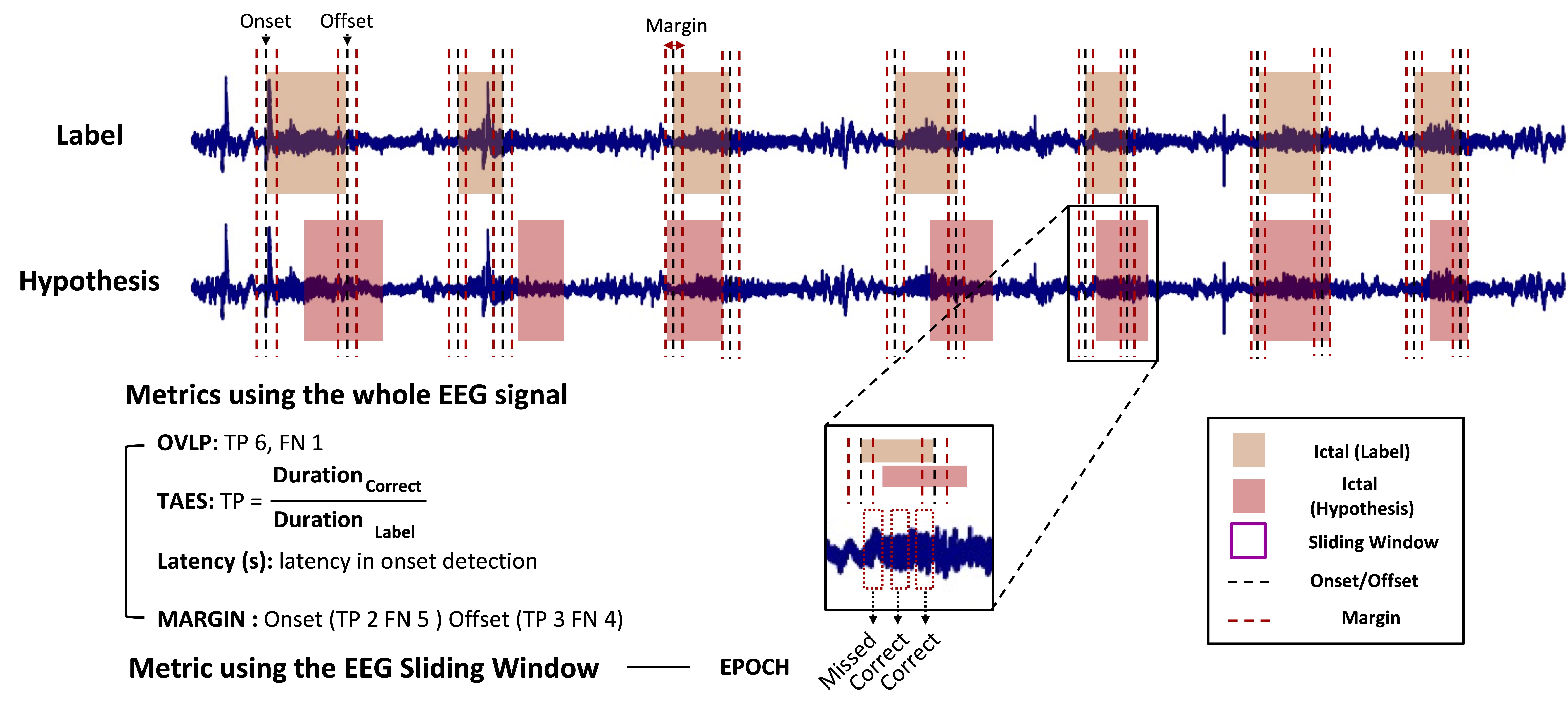 seizure-detection-wearable-eeg Diagram