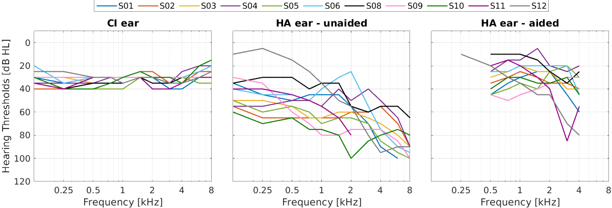 simulia-abaqus-cochlear-implant Diagram