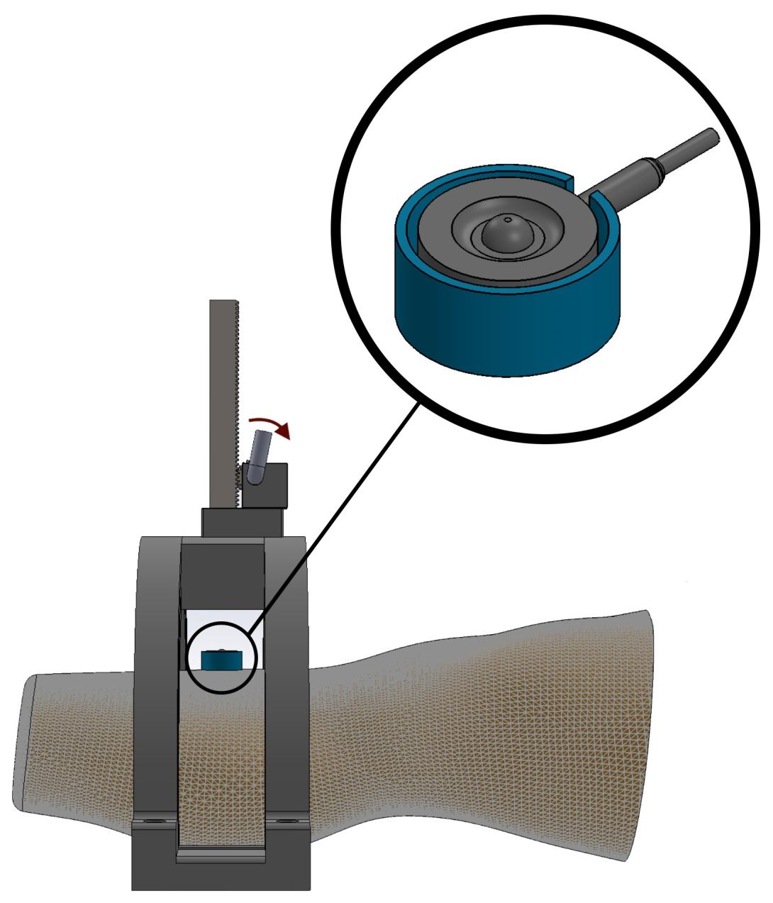simulia-abaqus-prosthetic-socket Diagram