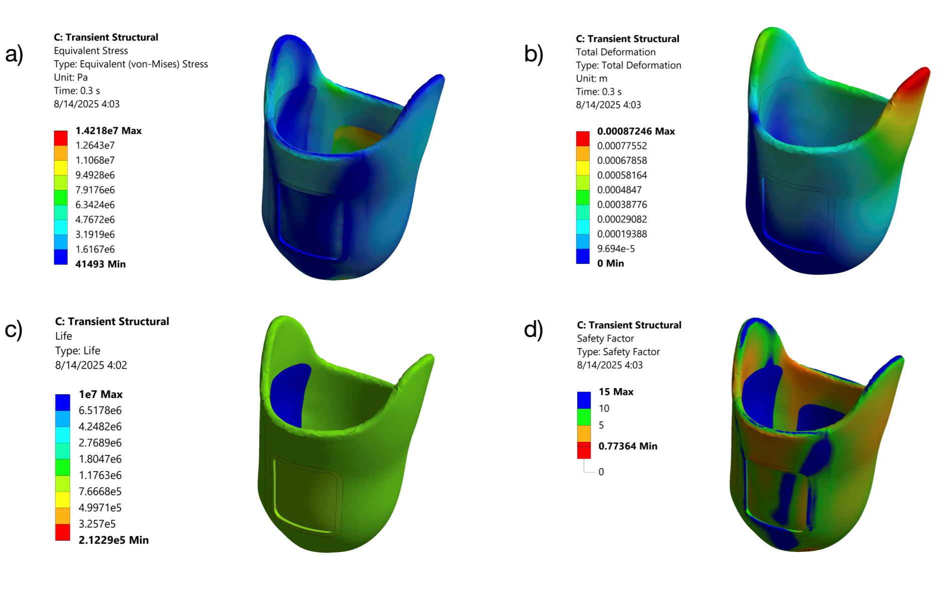 simulia-abaqus-prosthetic-socket Diagram