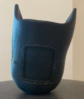 simulia-abaqus-prosthetic-socket Diagram