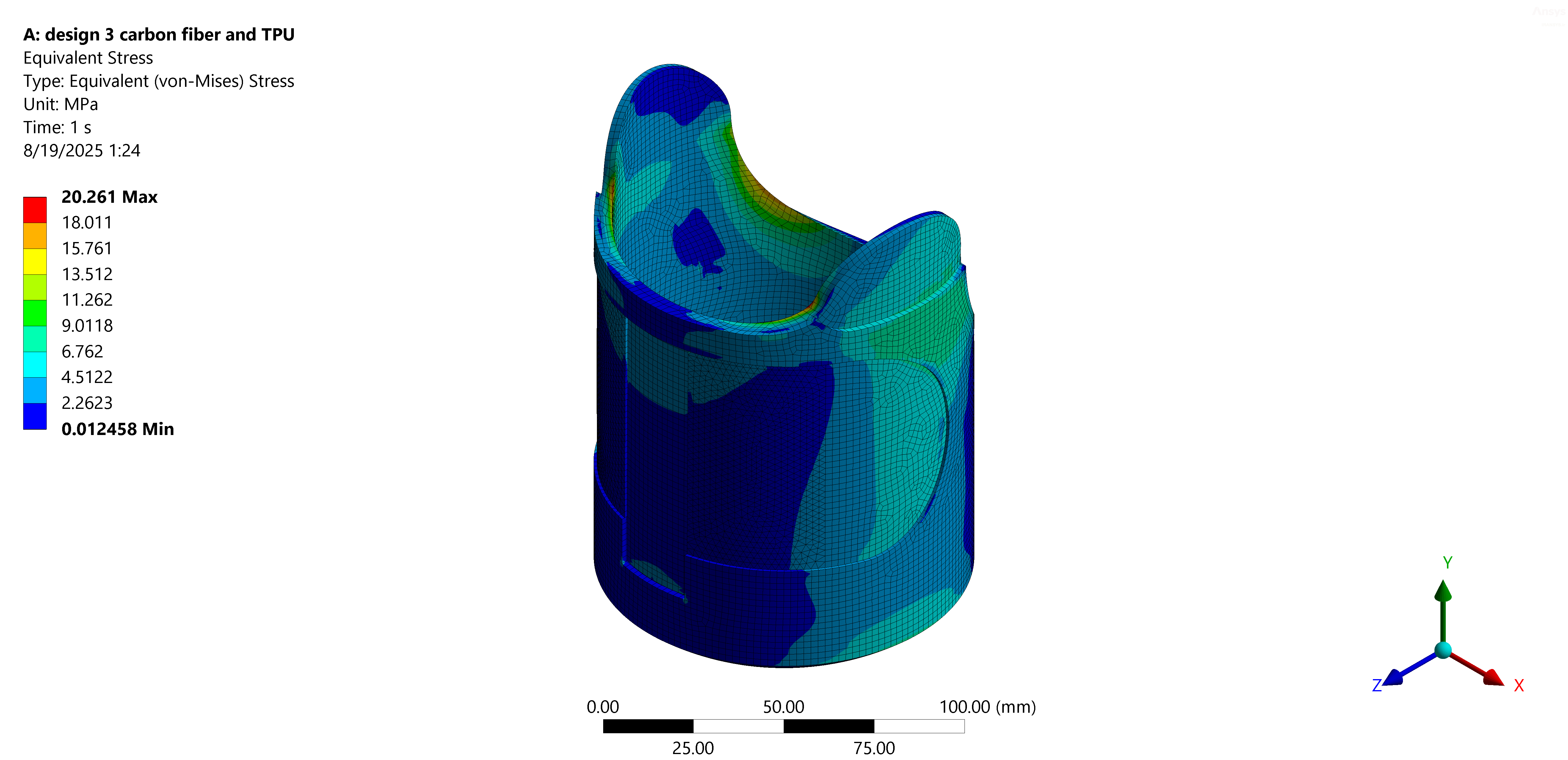 simulia-abaqus-prosthetic-socket Diagram