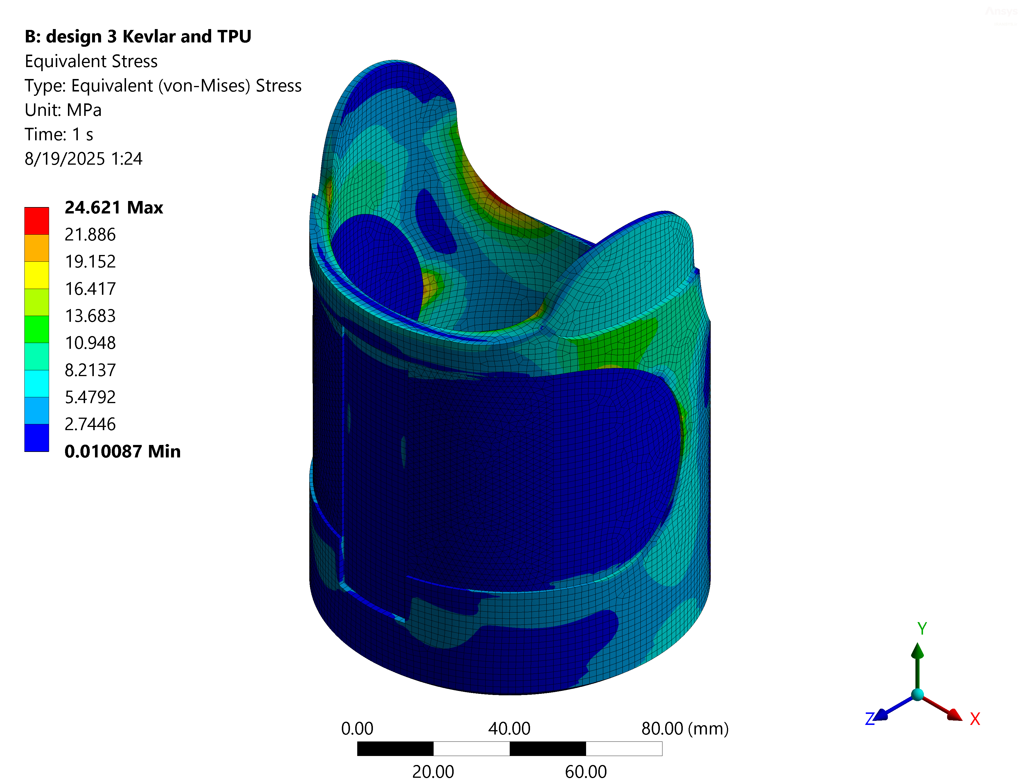 simulia-abaqus-prosthetic-socket Diagram