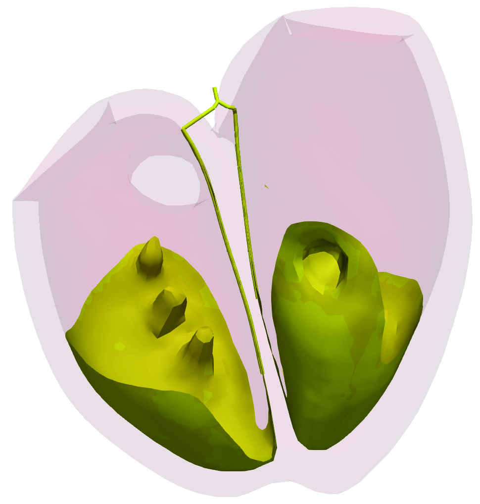 simulia-living-heart-electrophysiology Diagram