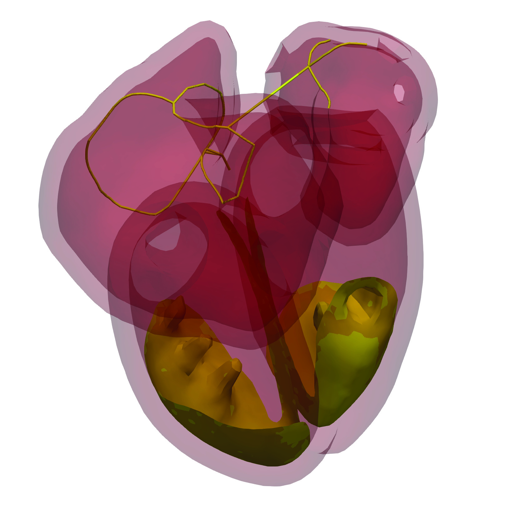 simulia-living-heart-electrophysiology Diagram