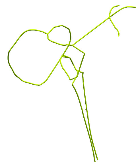 simulia-living-heart-electrophysiology Diagram