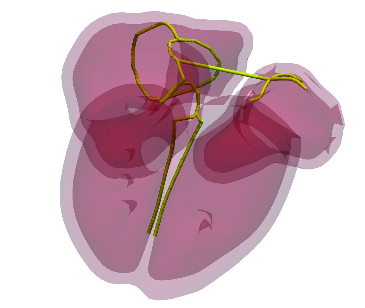 simulia-living-heart-electrophysiology Diagram