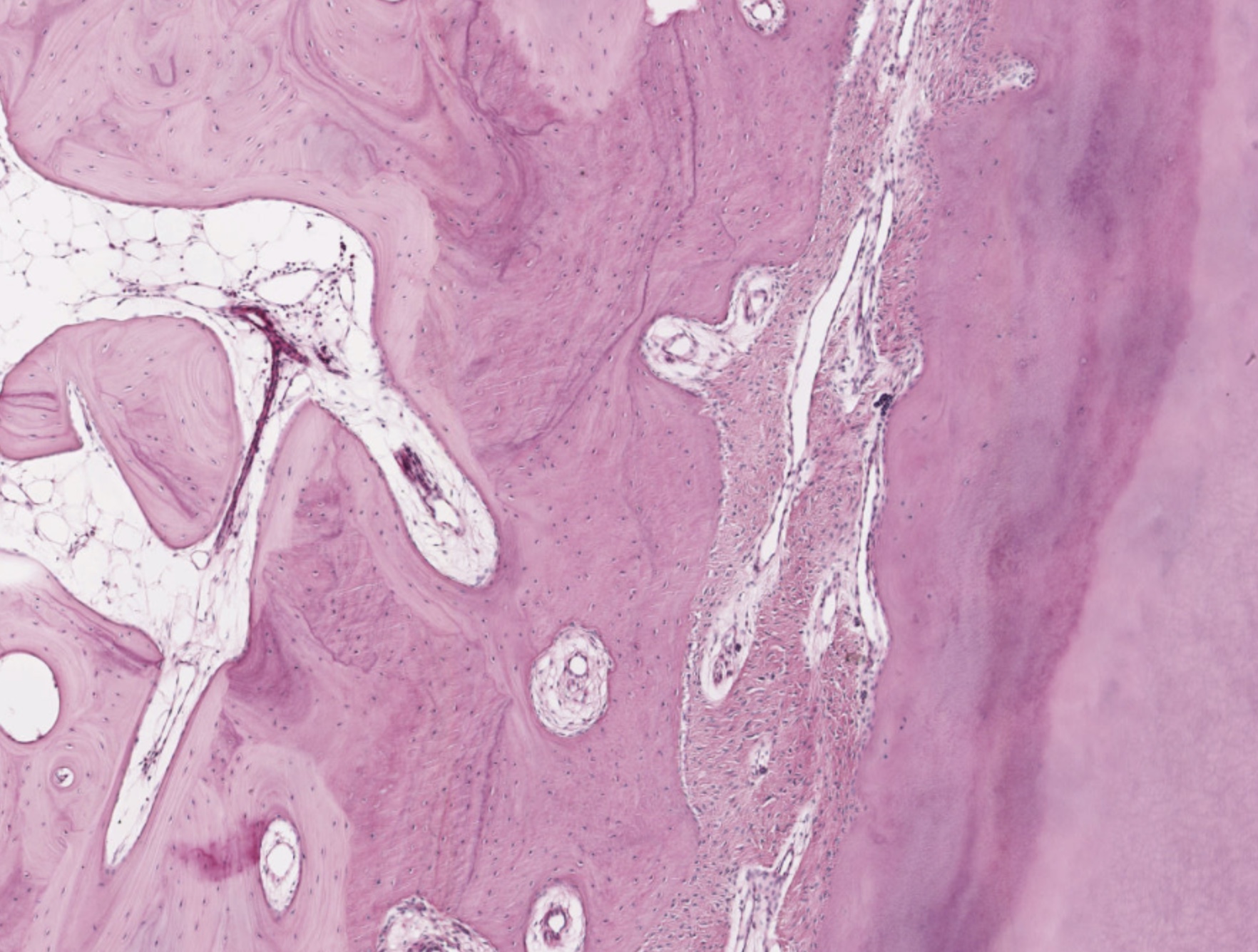 simulia-living-heart-pathology Diagram