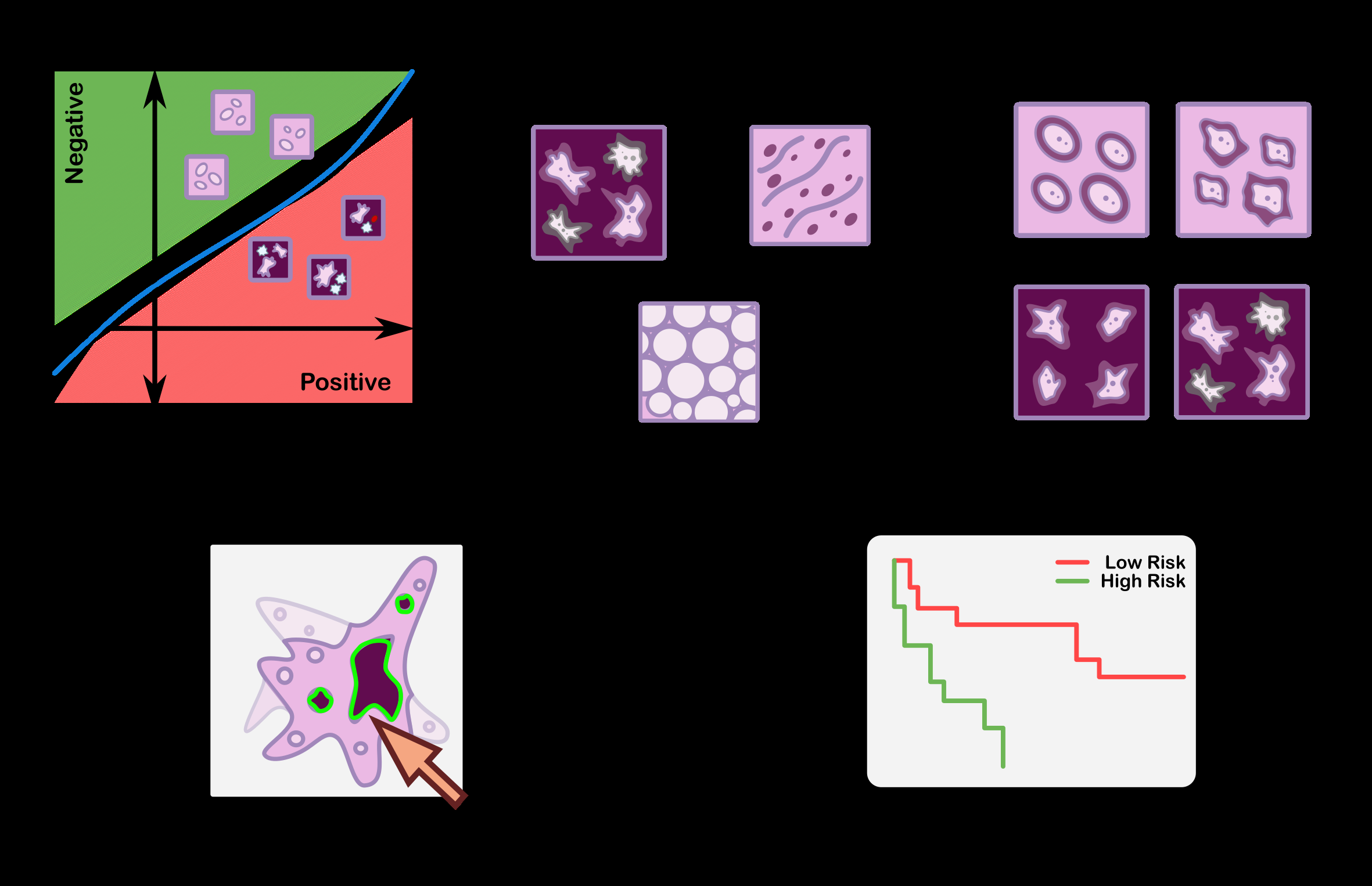 simulia-living-heart-pathology Diagram