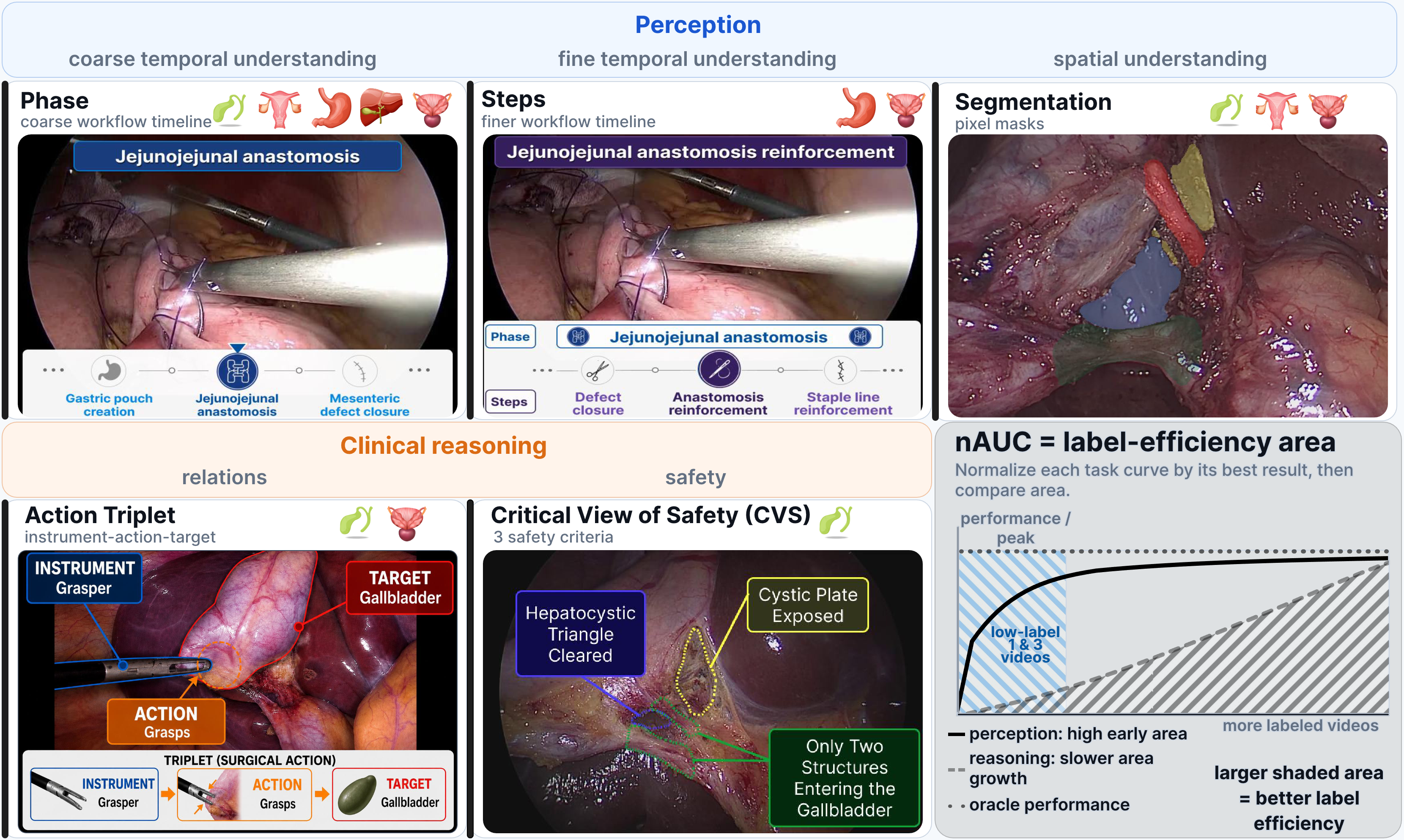 simulia-surgical-simulation Diagram