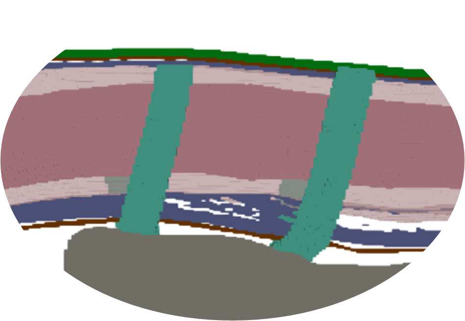 spinal-cord-stimulator-design Diagram