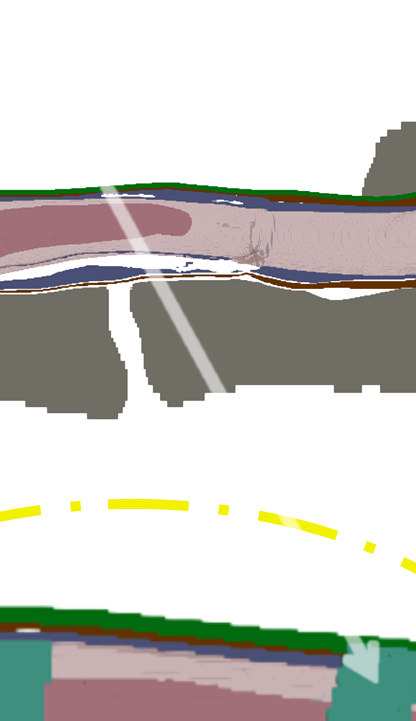 spinal-cord-stimulator-design Diagram