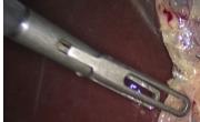 surgical-instrument-tracking-rfid Diagram