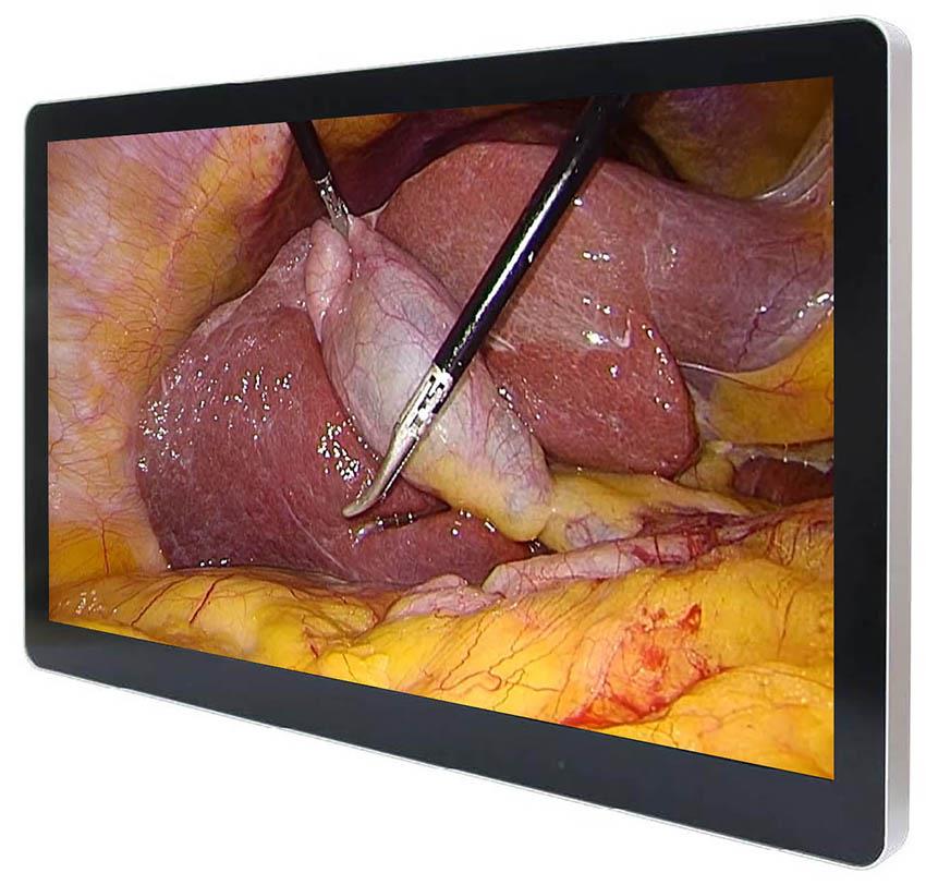 surgical-instrument-tracking-rfid Diagram