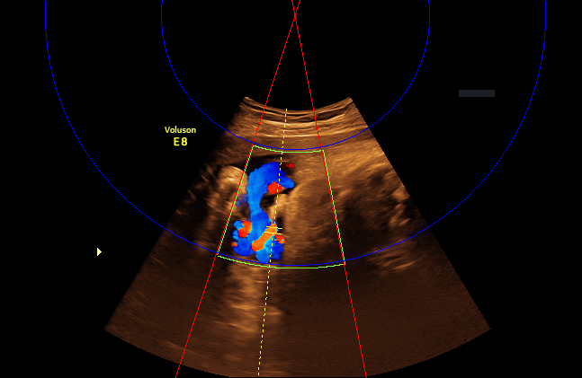 transcranial-doppler Diagram