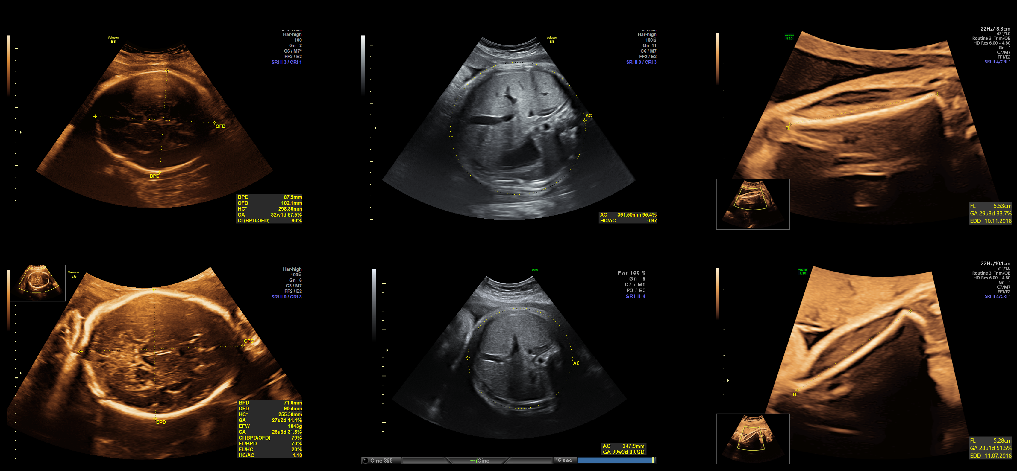 ultrasound-fetal-monitor-hardware Diagram