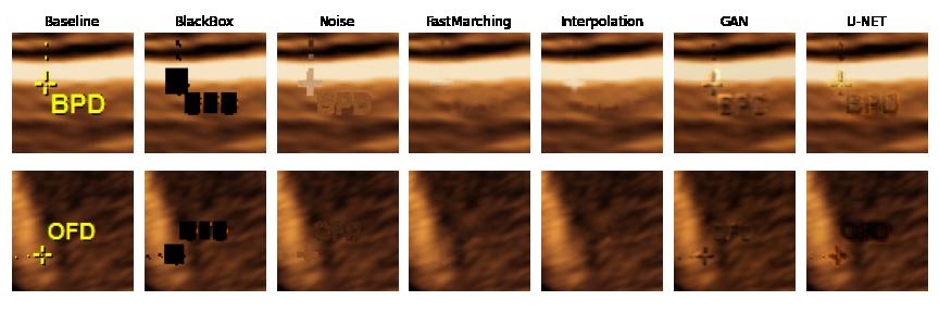 ultrasound-fetal-monitor-hardware Diagram