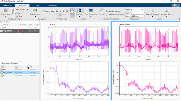 MATLAB DSP project speech processing Bangalore