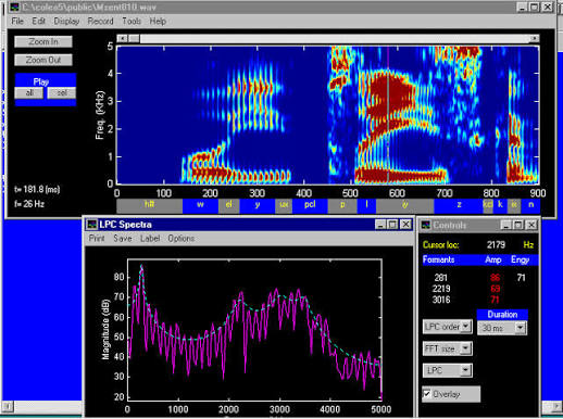 ECG signal processing MATLAB project Bangalore
