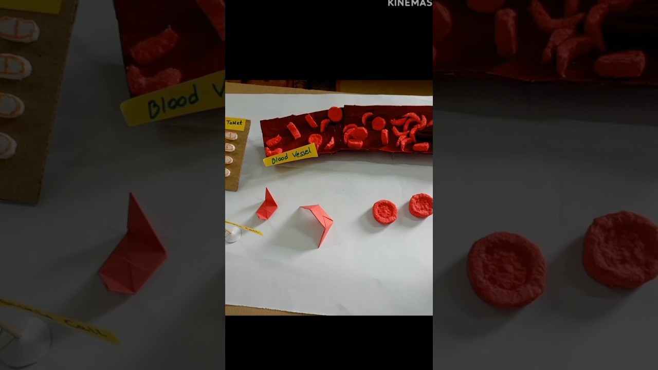 Figure 1: Working Model Setup, Scientific Diagram & Project Prototype for Sickle Cell Anemia Erythrocyte Capillary Blockage Model