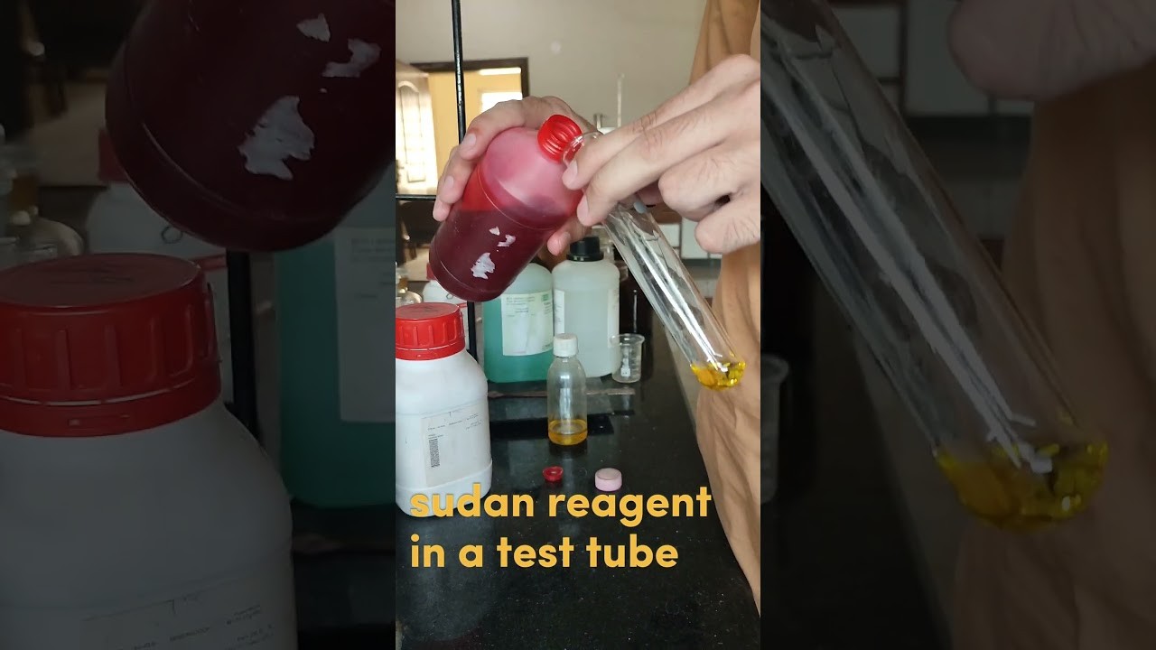 Figure 1: Working Model Setup, Scientific Diagram & Project Prototype for Sudan Iii Lipid Fat Globule Dye Absorption Model