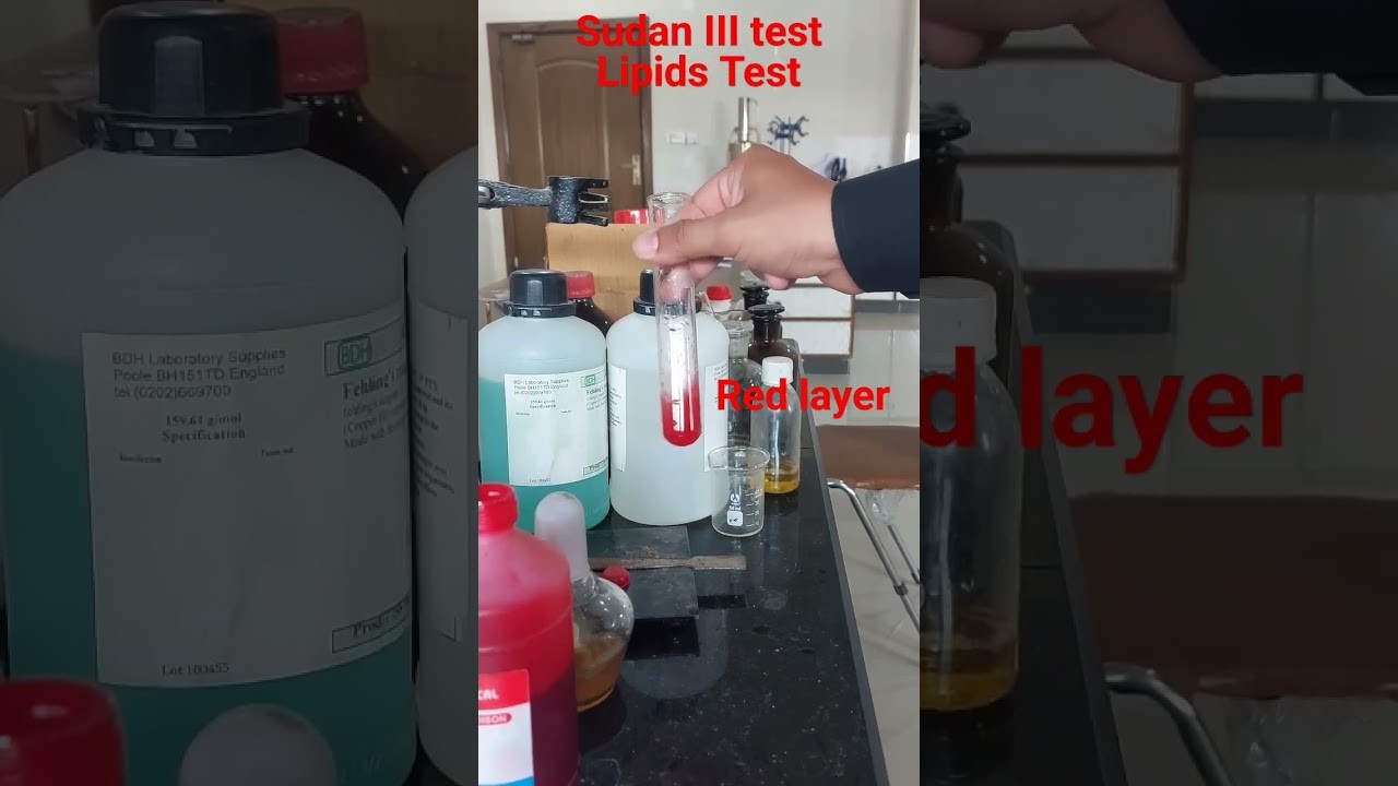 Figure 2: Working Model Setup, Scientific Diagram & Project Prototype for Sudan Iii Lipid Fat Globule Dye Absorption Model
